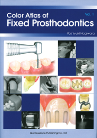 Color Atlas of Fixed Prosthodontics